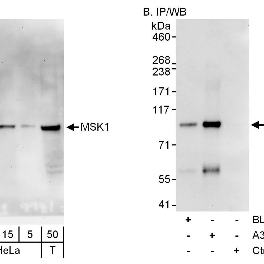 Rabbit anti-MSK1 Antibody, Affinity Purified