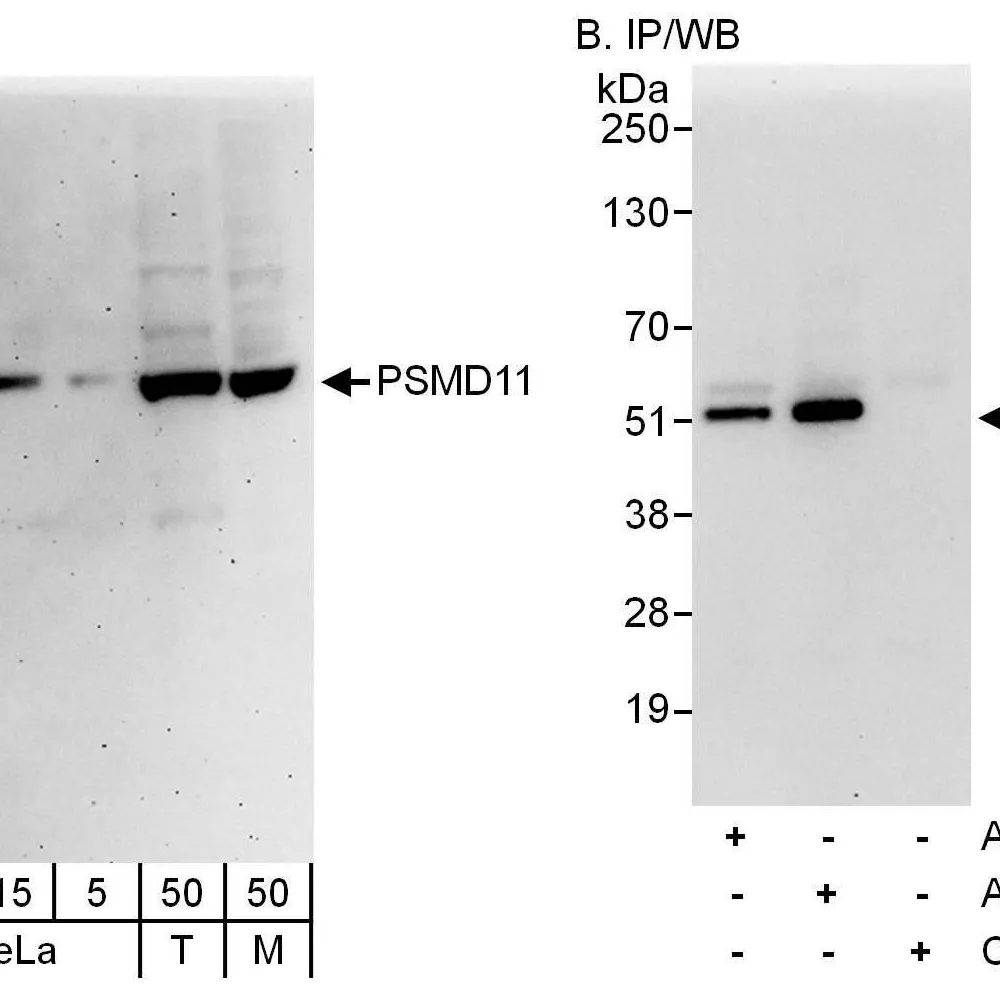 Rabbit anti-PSMD11 Antibody, Affinity Purified