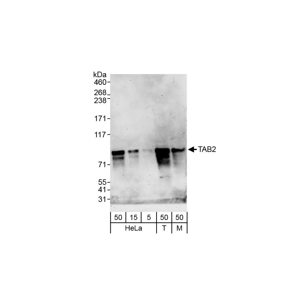 Rabbit anti-TAB2 Antibody, Affinity Purified