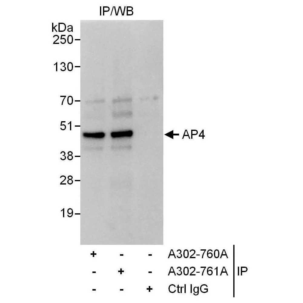 Rabbit anti-AP4 Antibody, Affinity Purified