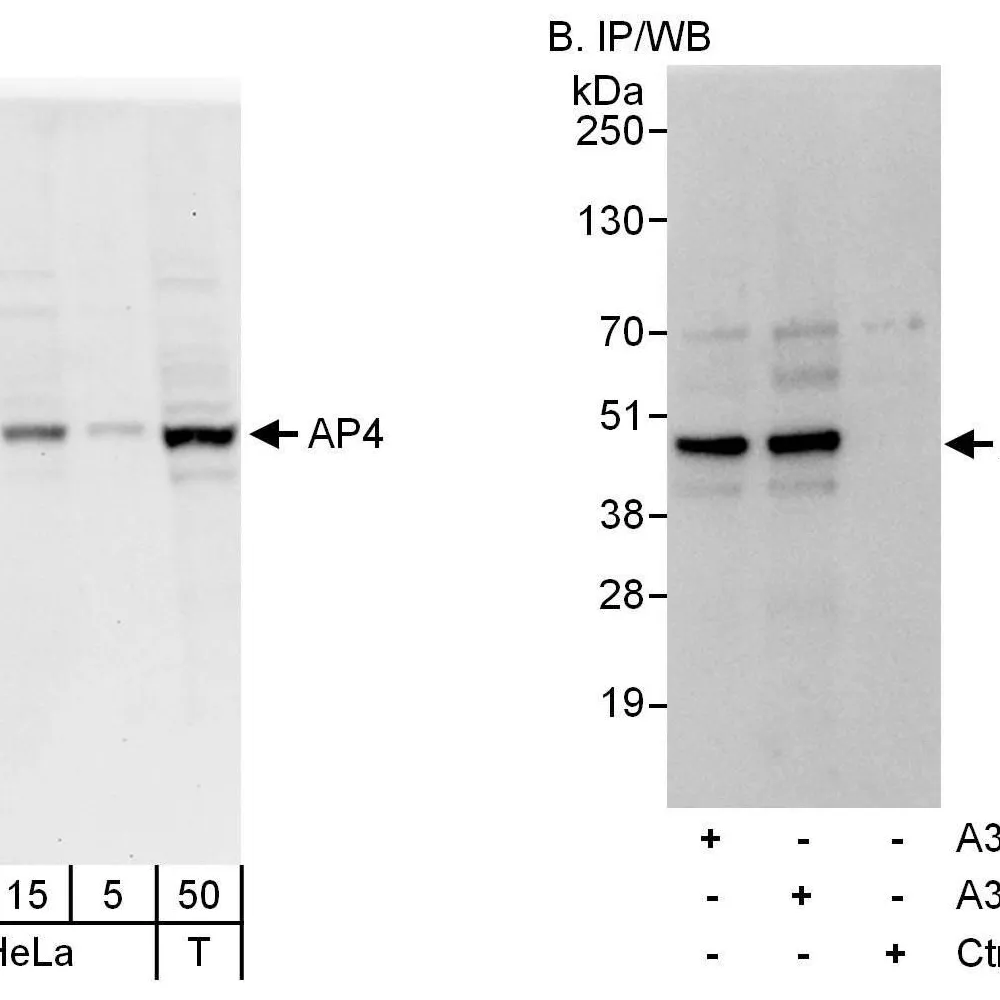 Rabbit anti-AP4 Antibody, Affinity Purified