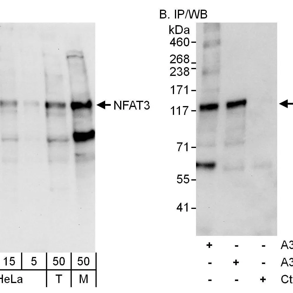 Rabbit anti-NFAT3 Antibody, Affinity Purified