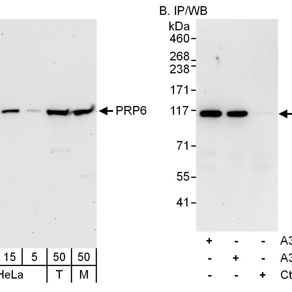 Rabbit anti-PRP6 Antibody, Affinity Purified