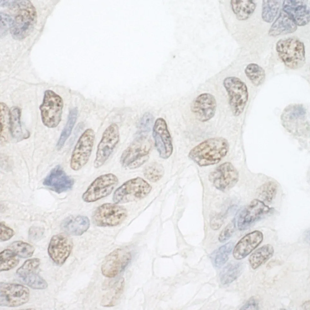 Rabbit anti-PRP6 Antibody, Affinity Purified