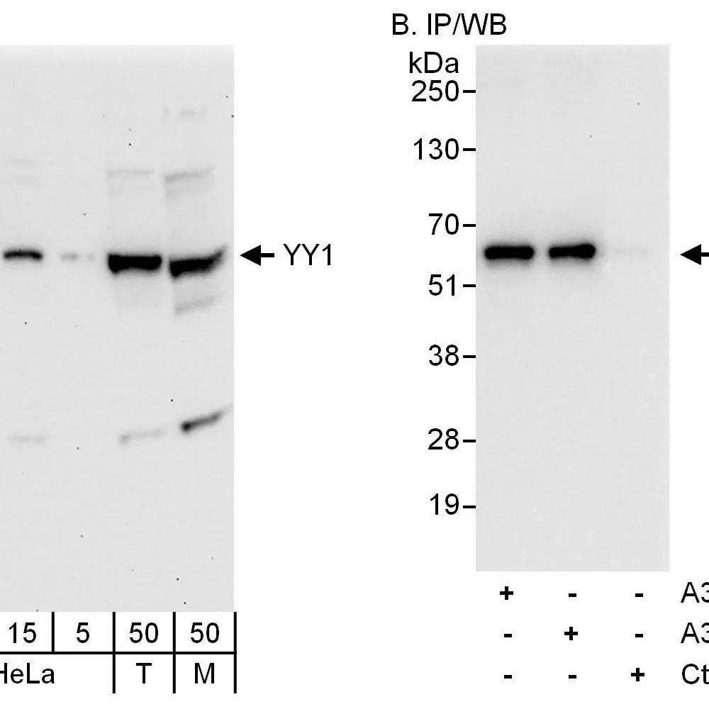 Rabbit anti-YY1 Antibody, Affinity Purified