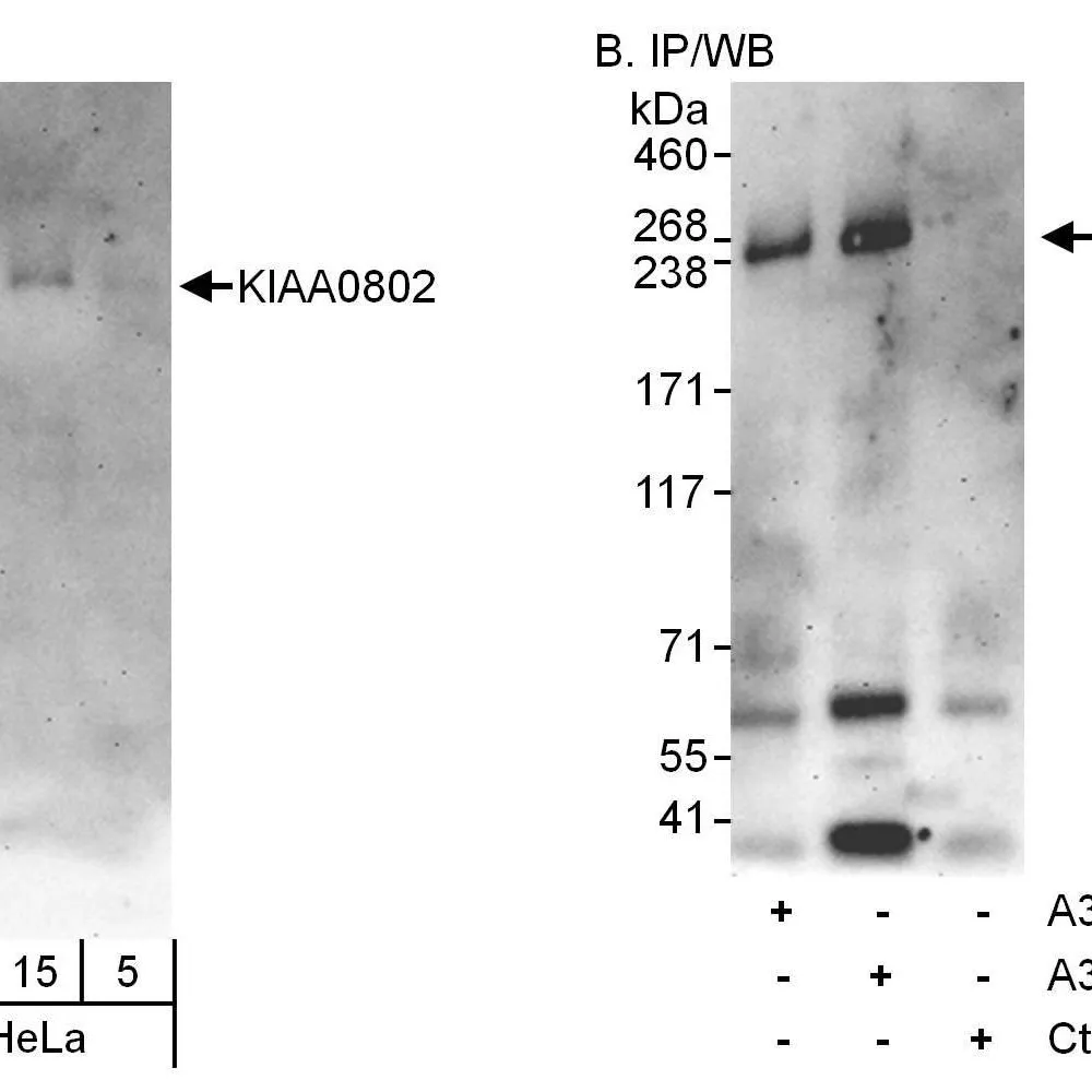 Rabbit anti-KIAA0802 Antibody, Affinity Purified