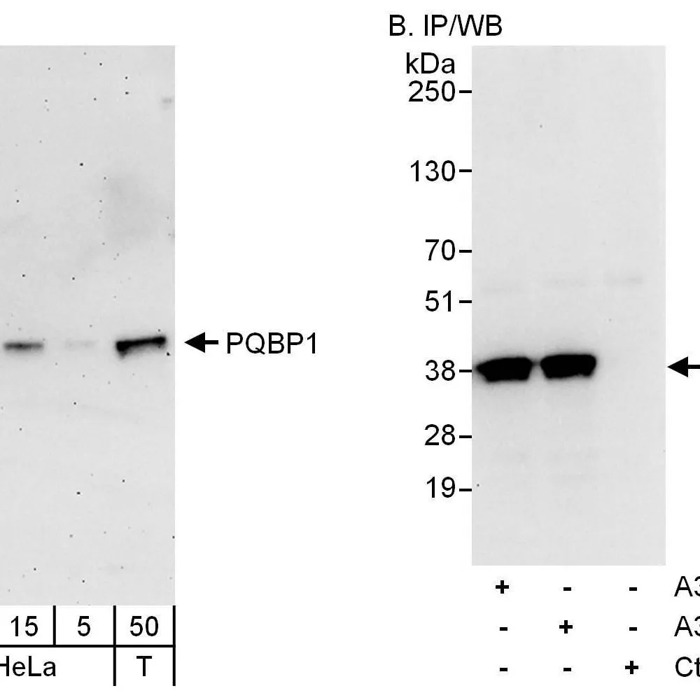 Rabbit anti-PQBP1 Antibody, Affinity Purified