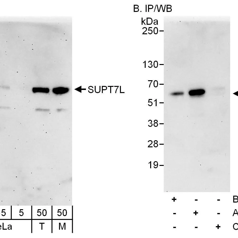 Rabbit anti-SUPT7L Antibody, Affinity Purified