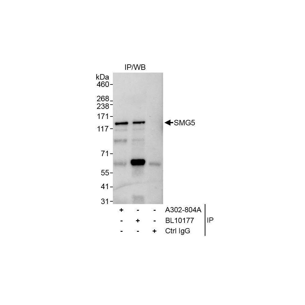 Rabbit anti-SMG5 Antibody, Affinity Purified
