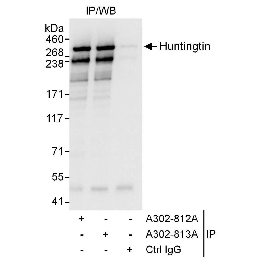 Rabbit anti-Huntingtin Antibody, Affinity Purified