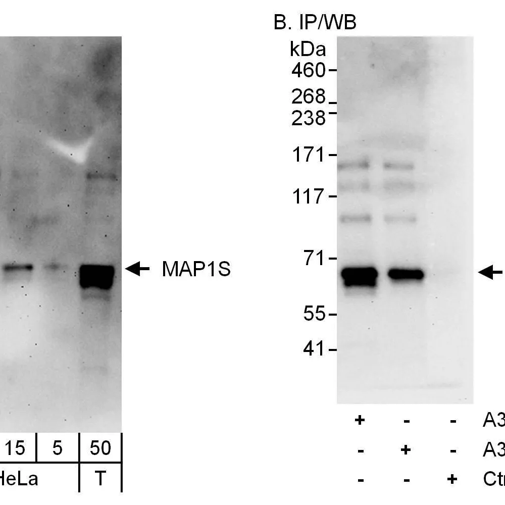Rabbit anti-MAP1S Antibody, Affinity Purified