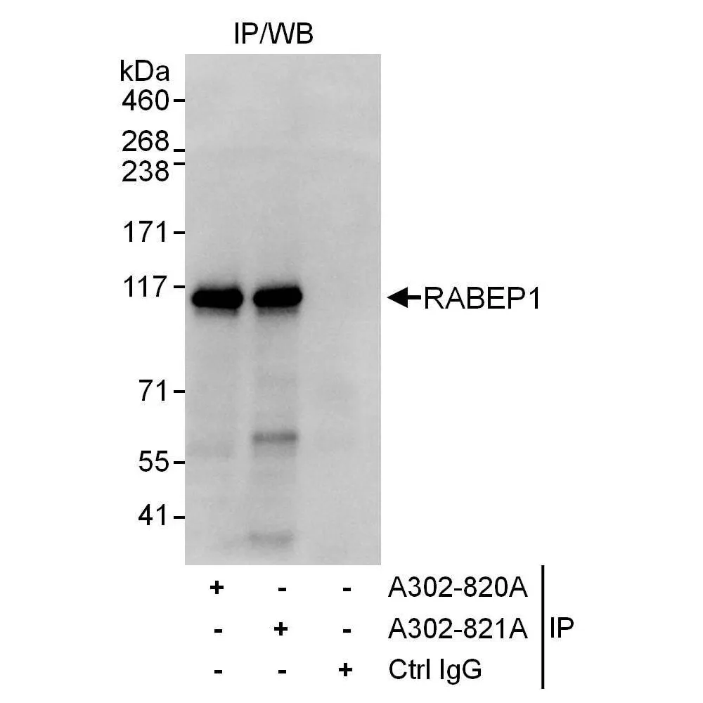 Rabbit anti-RABEP1 Antibody, Affinity Purified