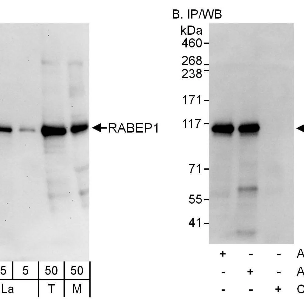Rabbit anti-RABEP1 Antibody, Affinity Purified