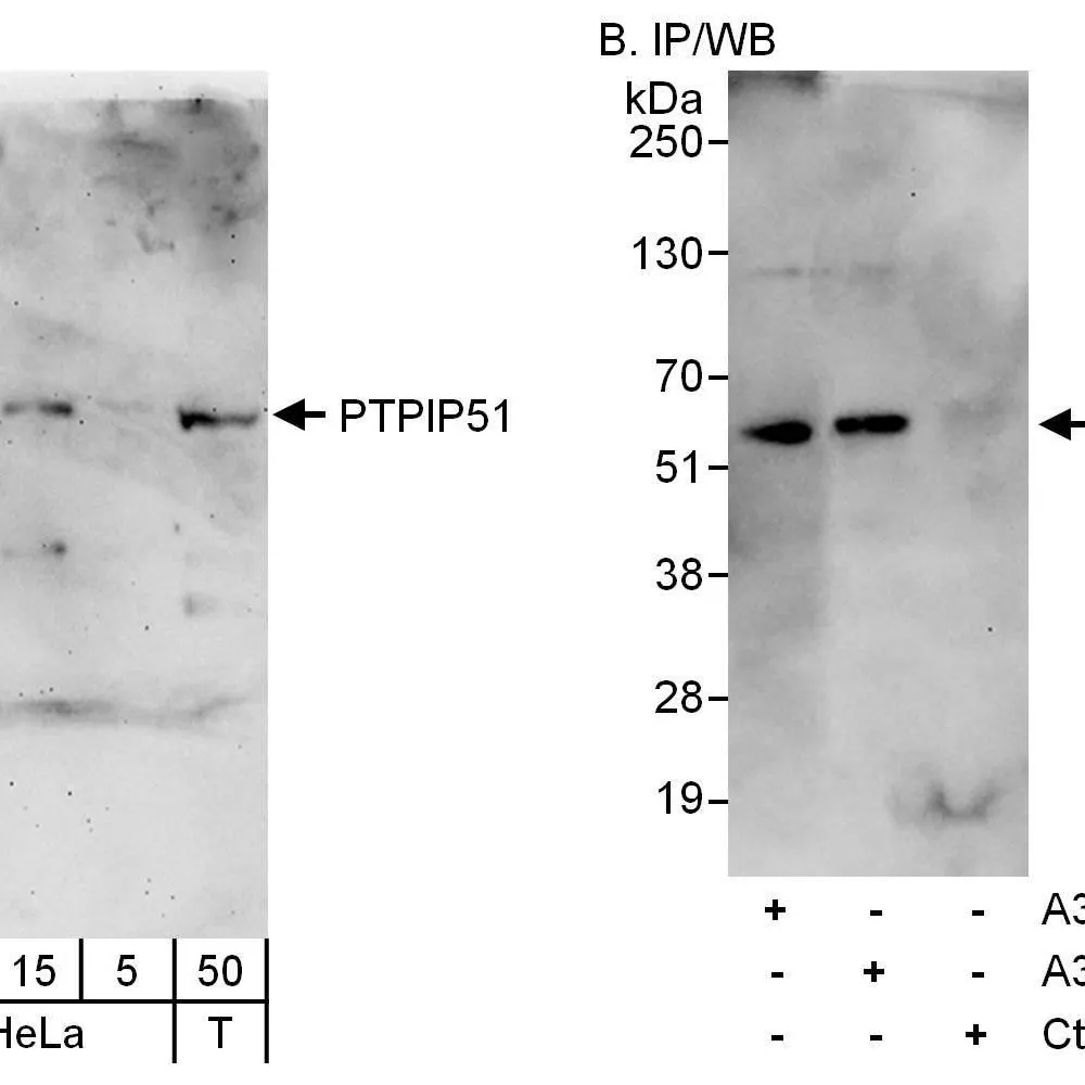 Rabbit anti-PTPIP51 Antibody, Affinity Purified