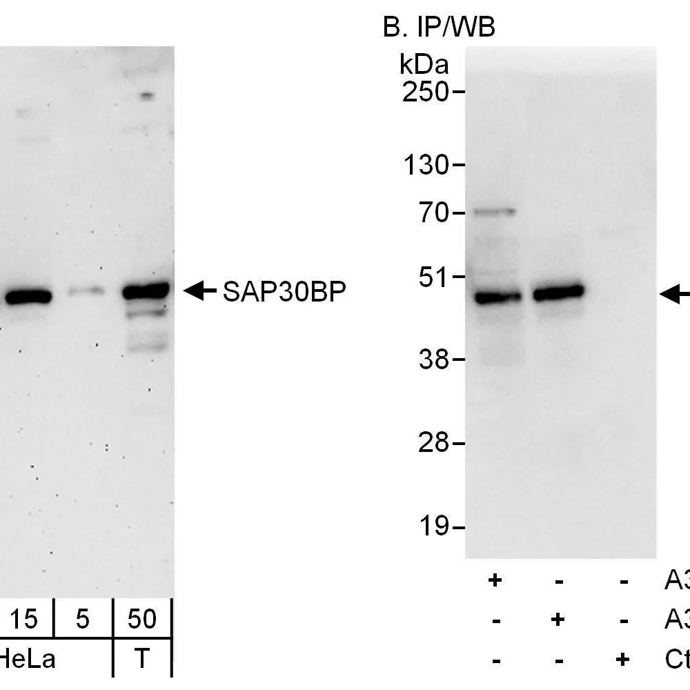 Rabbit anti-SAP30BP Antibody, Affinity Purified