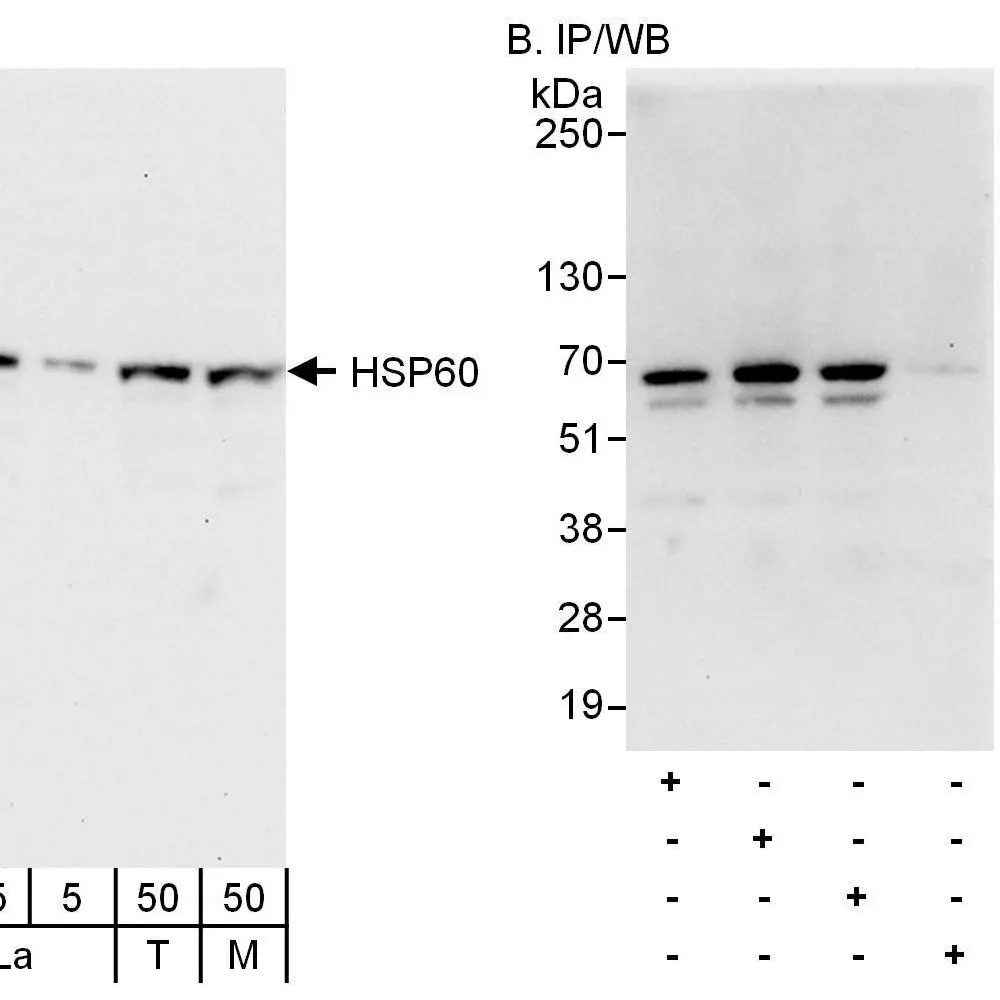 Rabbit anti-HSP60 Antibody, Affinity Purified