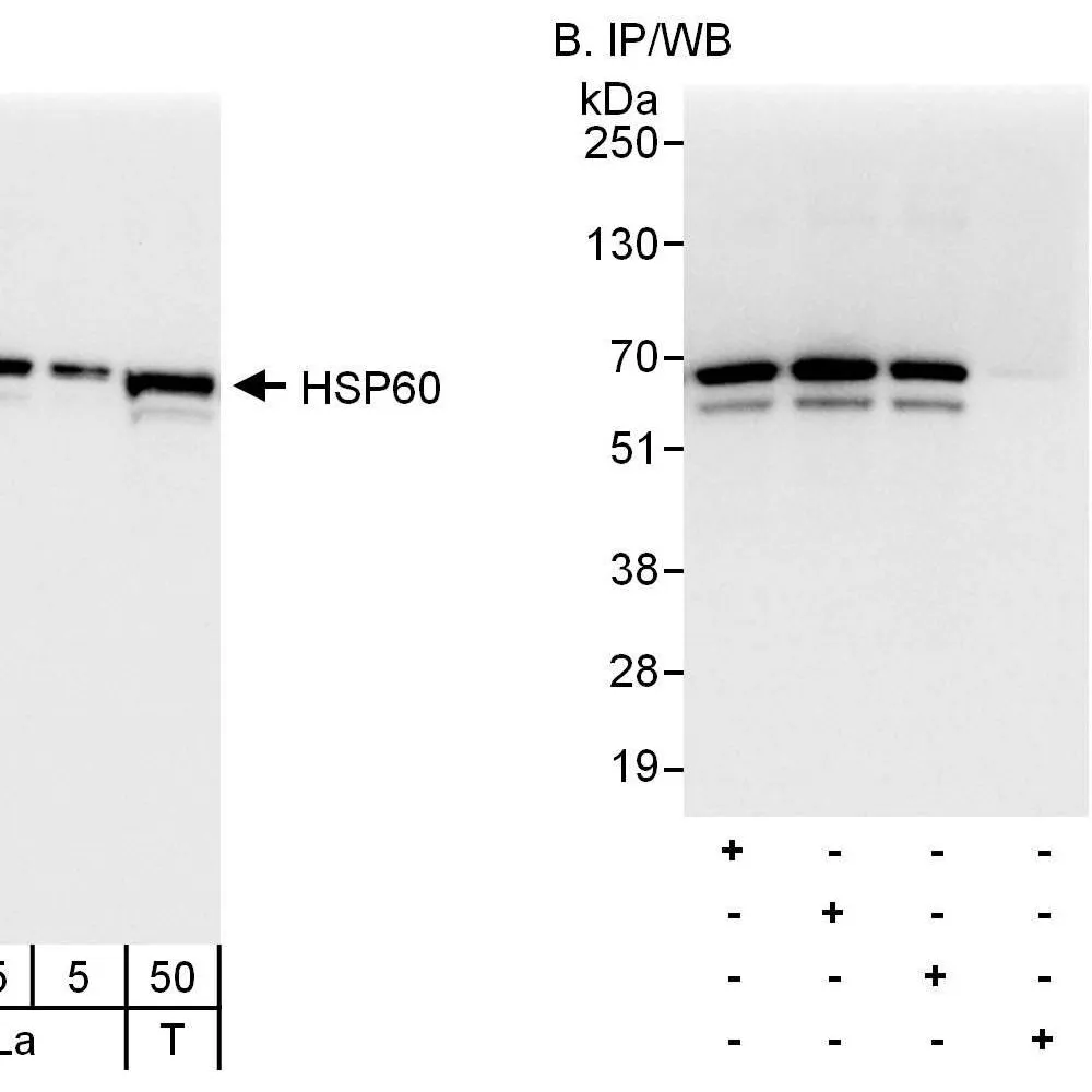 Rabbit anti-HSP60 Antibody, Affinity Purified