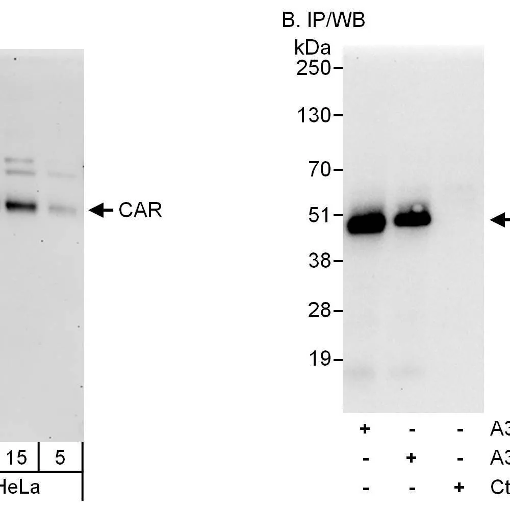 Rabbit anti-CAR Antibody, Affinity Purified
