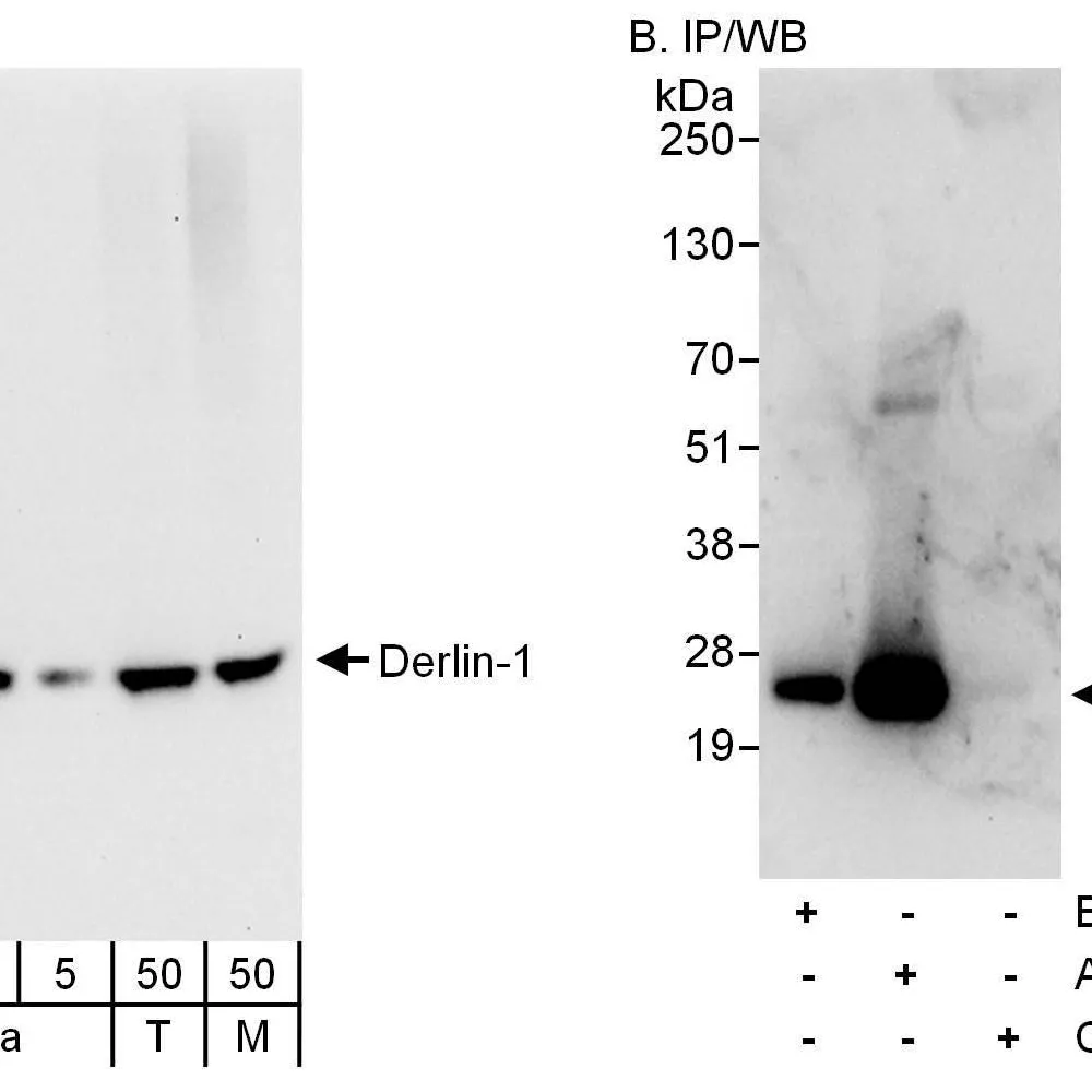 Rabbit anti-Derlin-1 Antibody, Affinity Purified