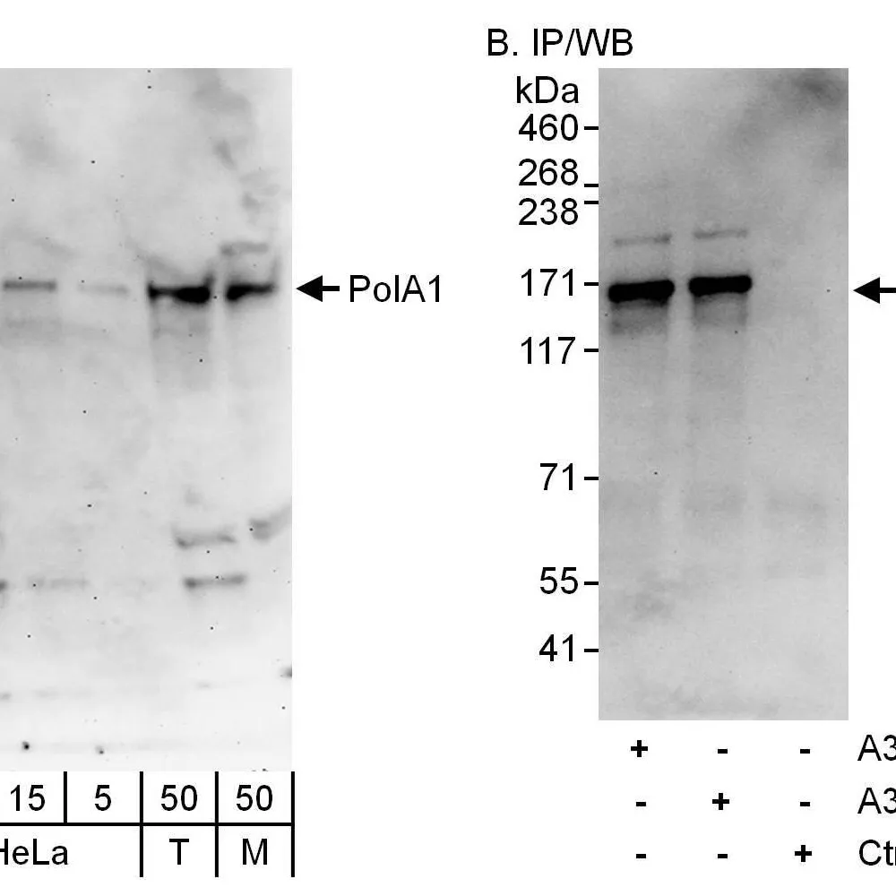 Rabbit anti-PolA1 Antibody, Affinity Purified