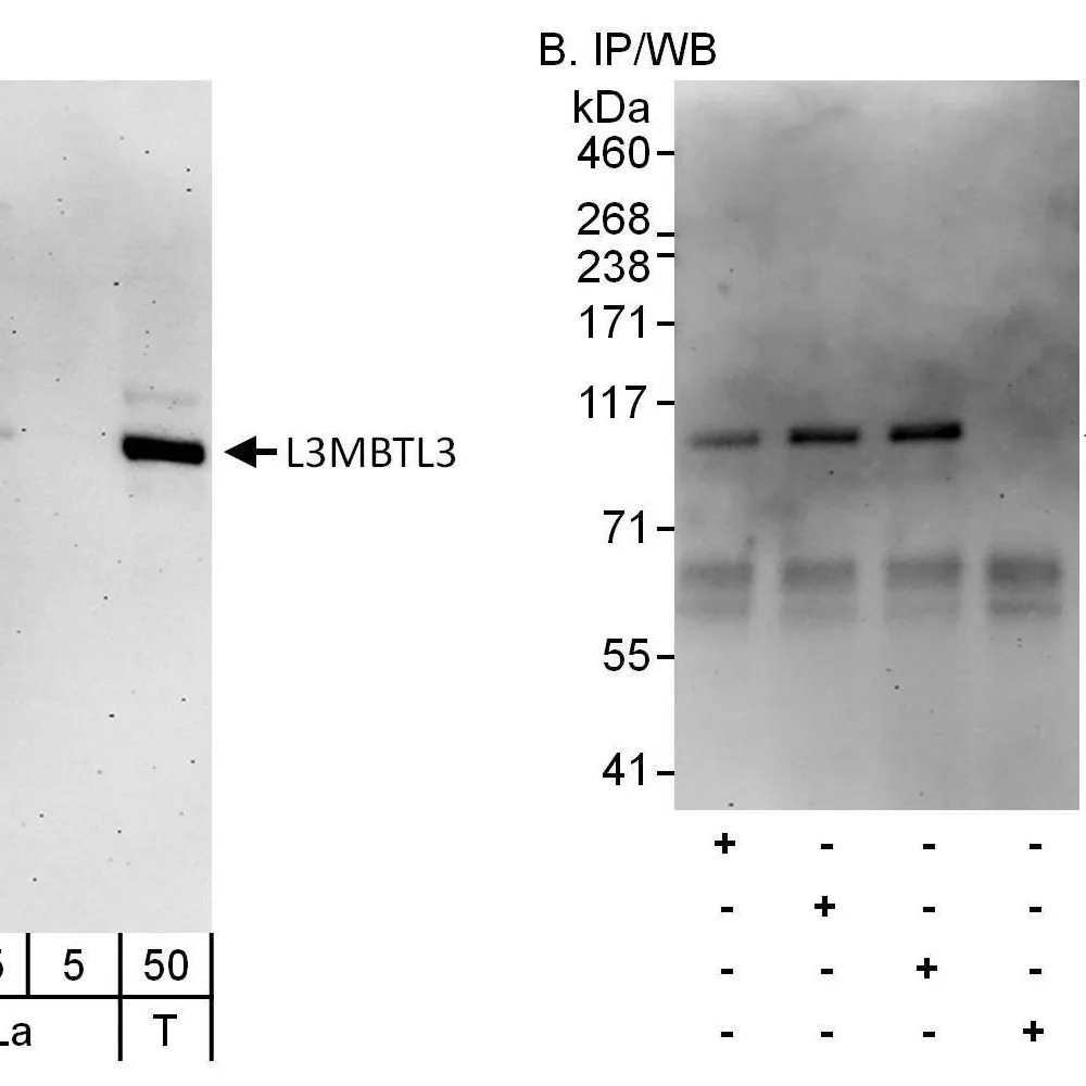 Rabbit anti-L3MBTL3 Antibody, Affinity Purified