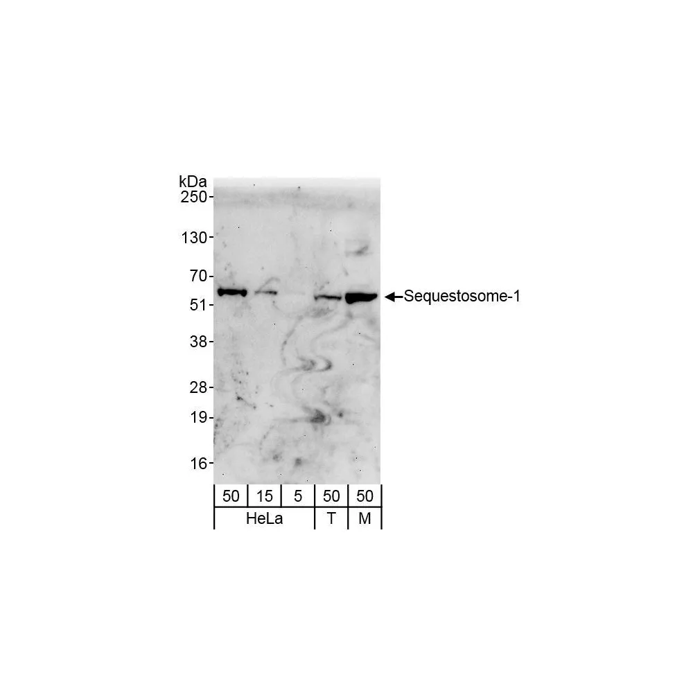 Rabbit anti-Sequestosome-1 Antibody, Affinity Purified
