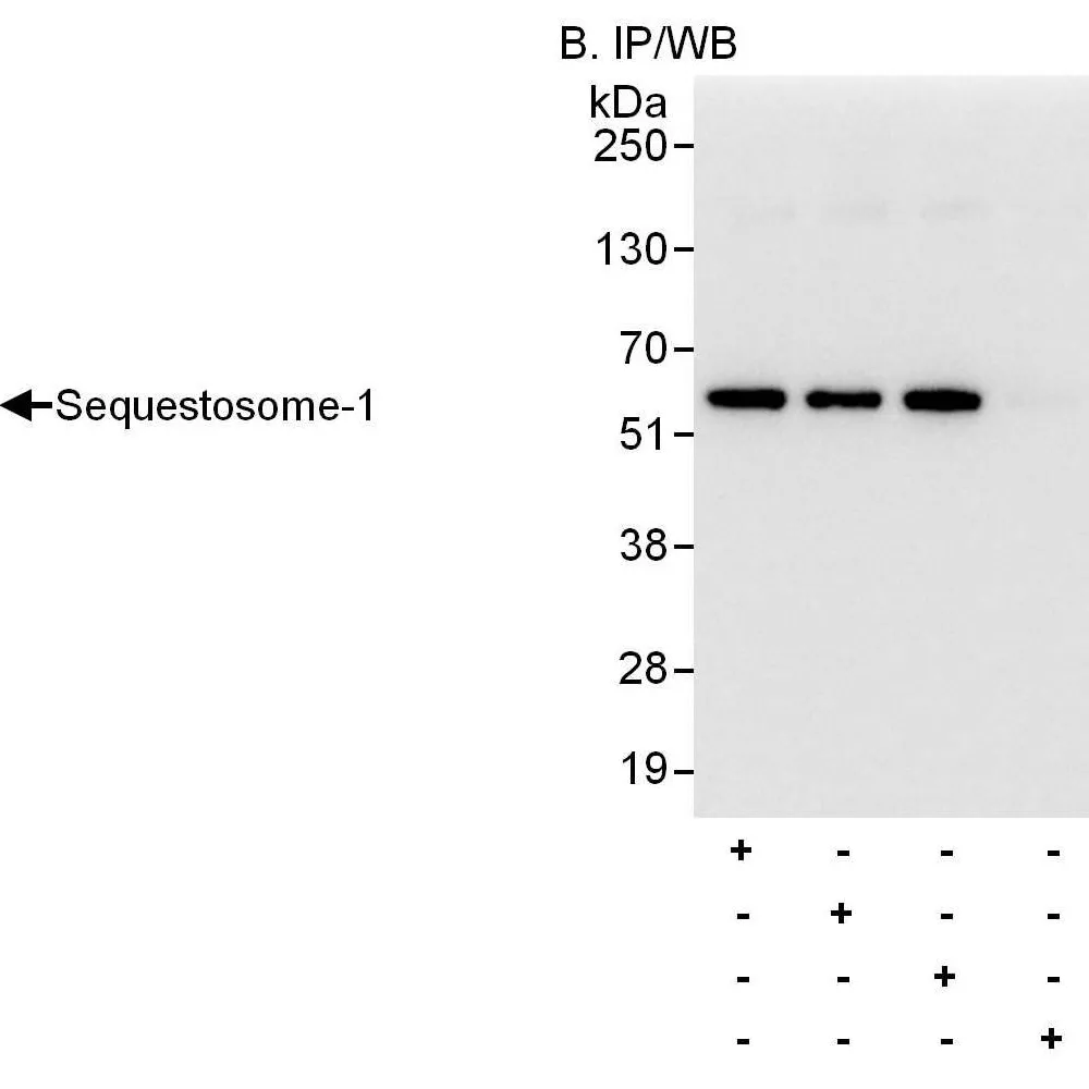 Rabbit anti-Sequestosome-1 Antibody, Affinity Purified
