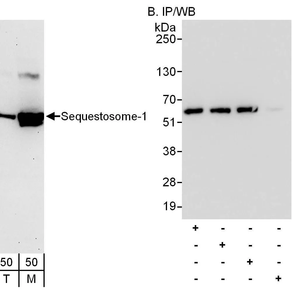 Rabbit anti-Sequestosome-1 Antibody, Affinity Purified
