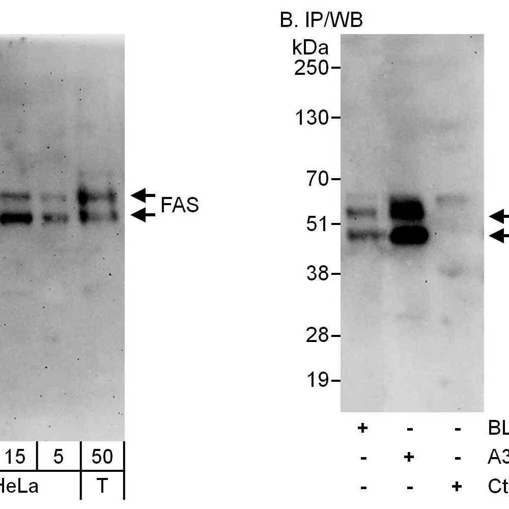 Rabbit anti-FAS Antibody, Affinity Purified