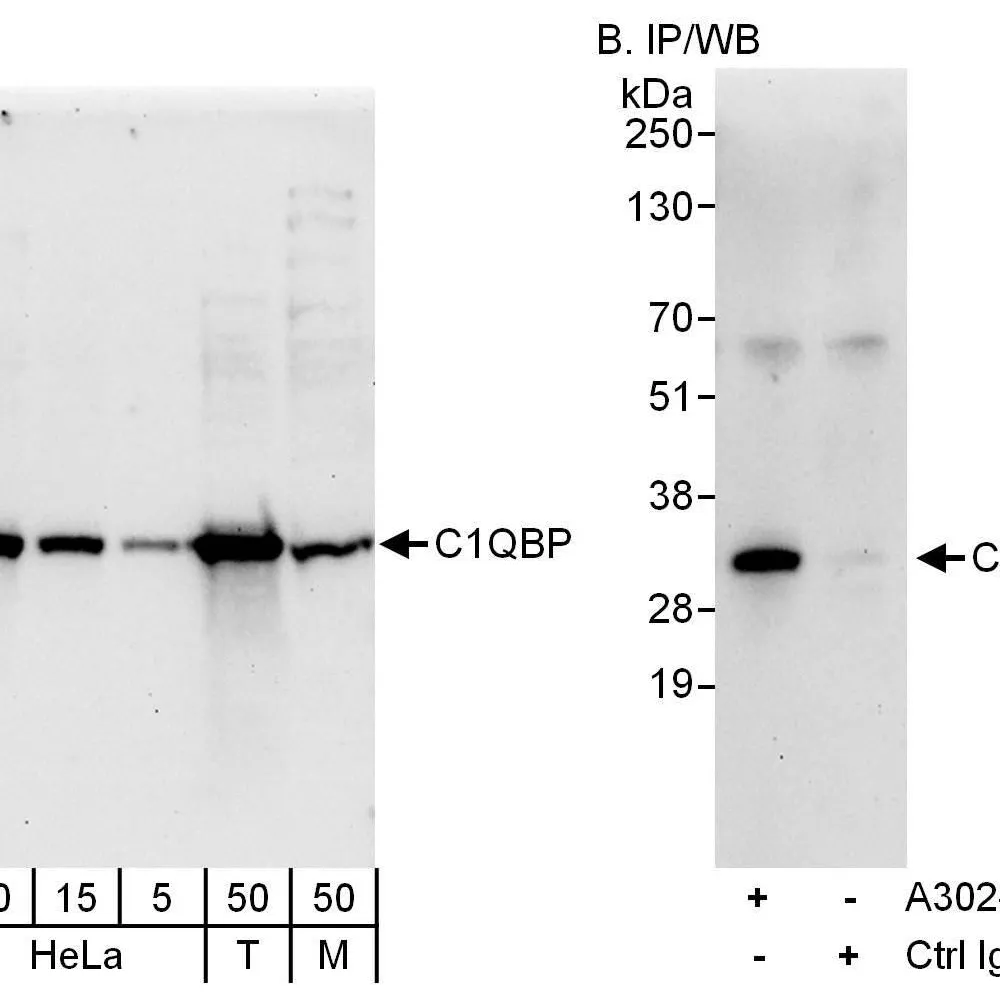 Rabbit anti-C1QBP Antibody, Affinity Purified