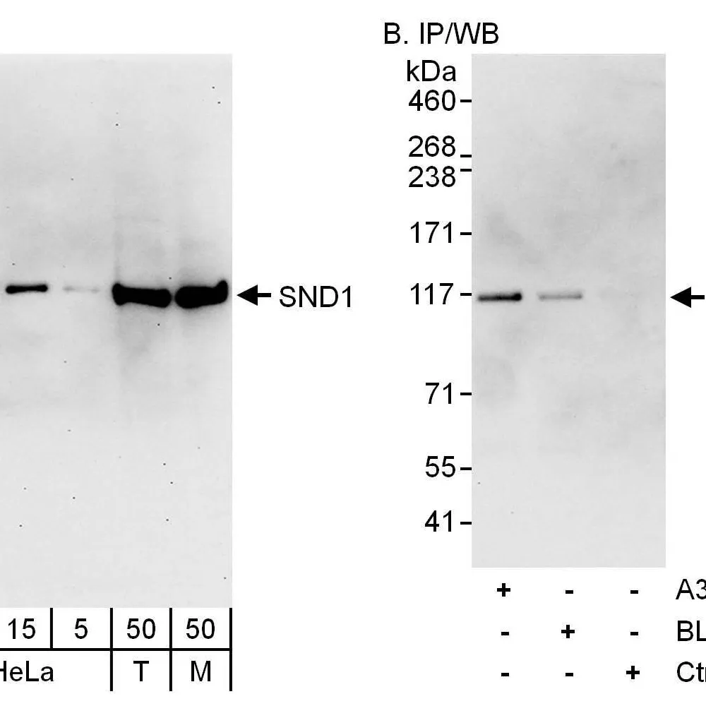 Rabbit anti-SND1 Antibody, Affinity Purified