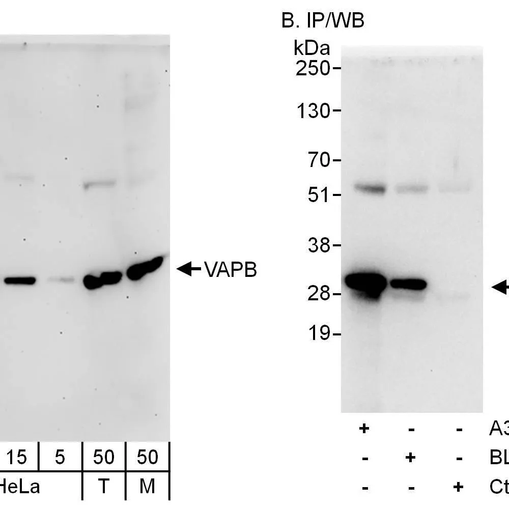 Rabbit anti-VAPB Antibody, Affinity Purified