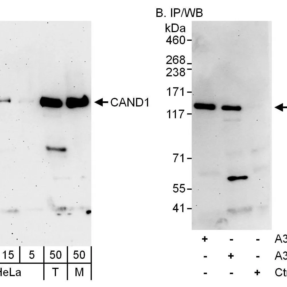 Rabbit anti-CAND1 Antibody, Affinity Purified