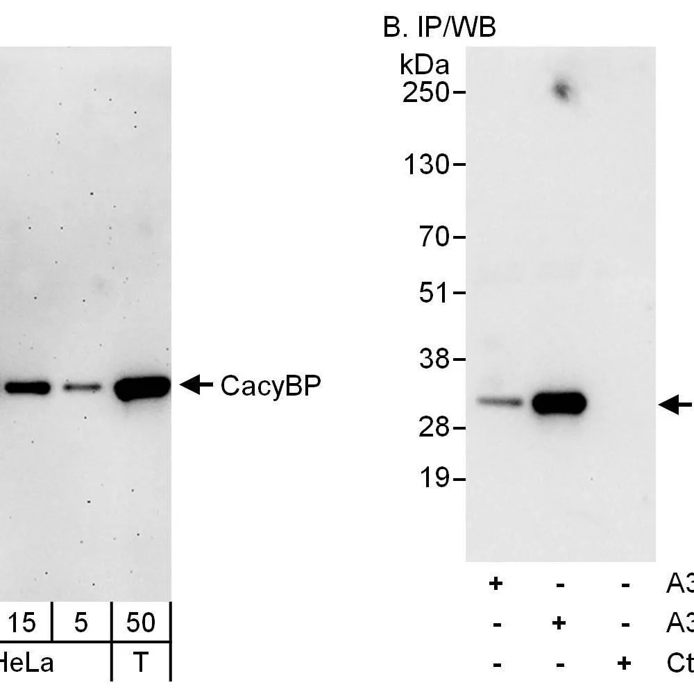Rabbit anti-CacyBP Antibody, Affinity Purified