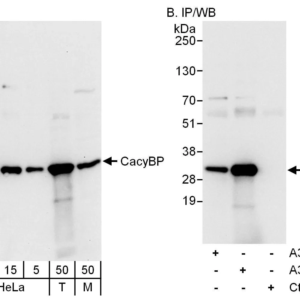 Rabbit anti-CacyBP Antibody, Affinity Purified