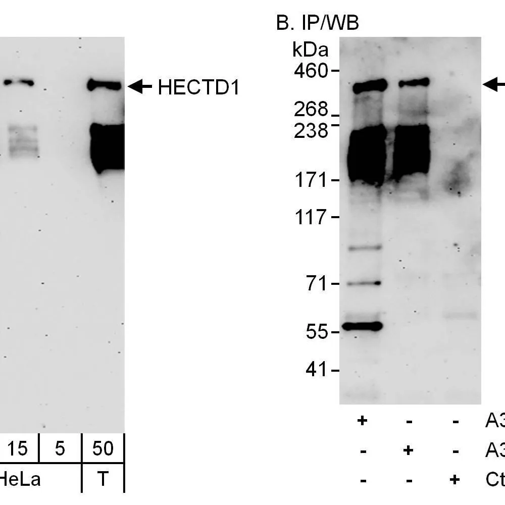 Rabbit anti-HECTD1 Antibody, Affinity Purified
