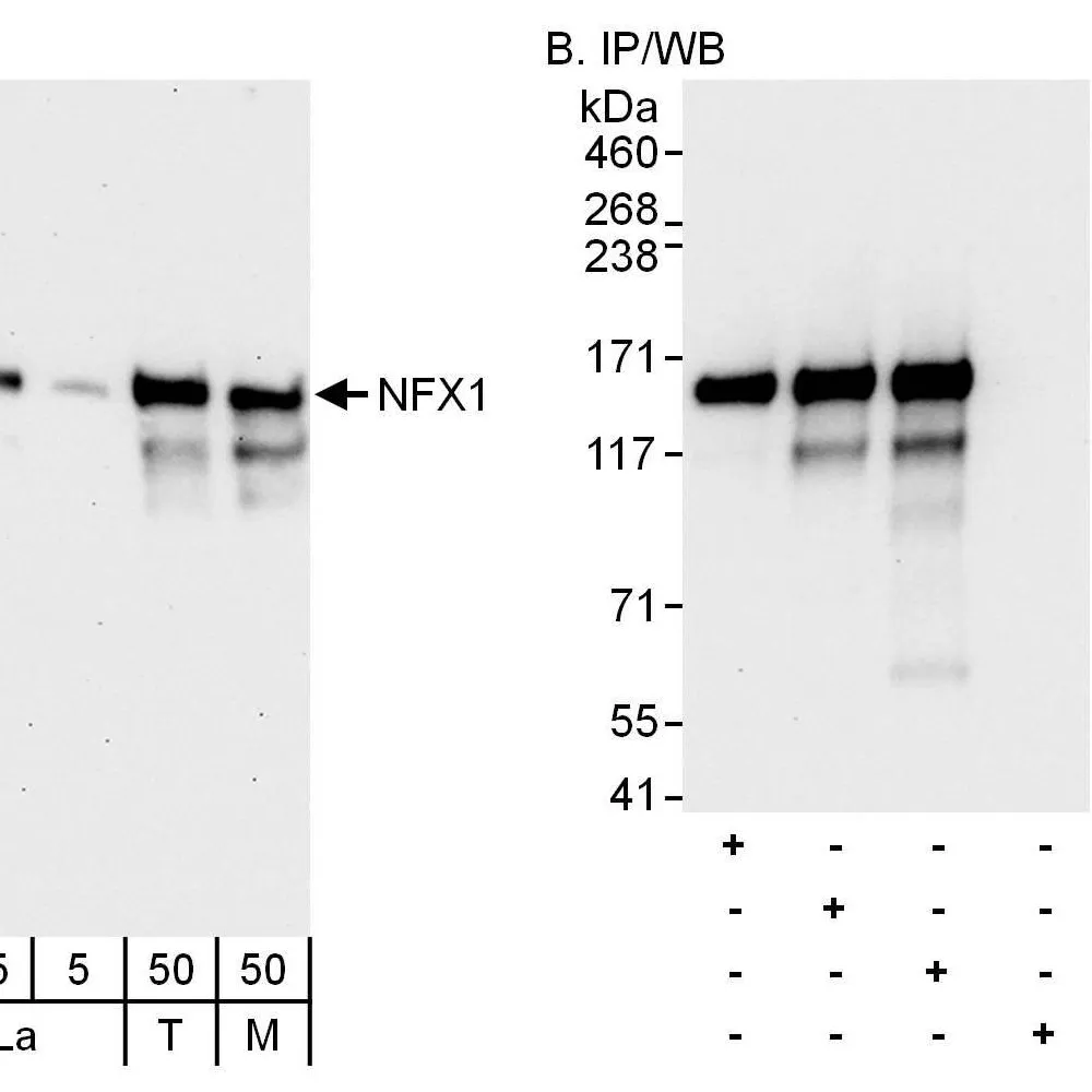 Rabbit anti-NFX1 Antibody, Affinity Purified