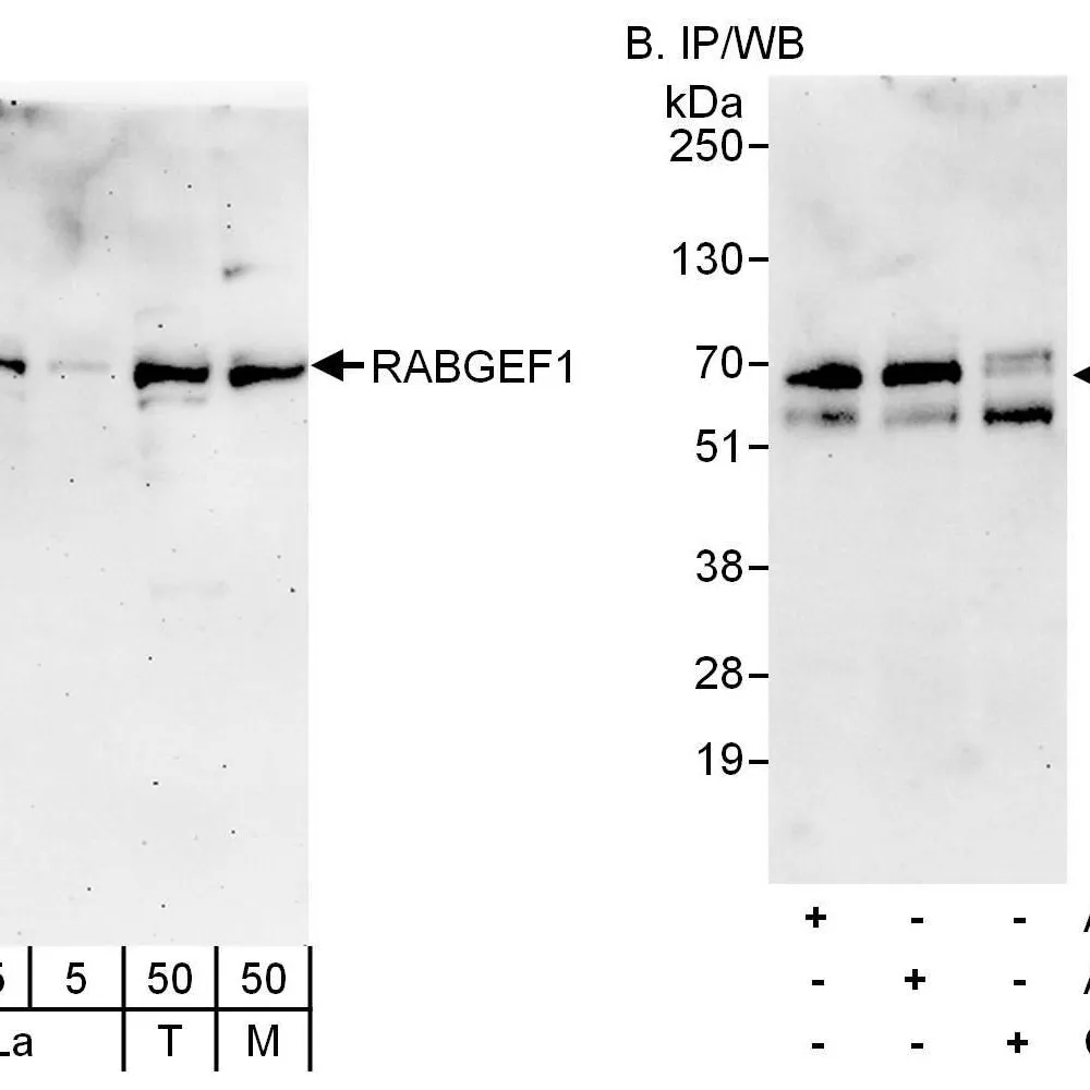 Rabbit anti-RABGEF1 Antibody, Affinity Purified