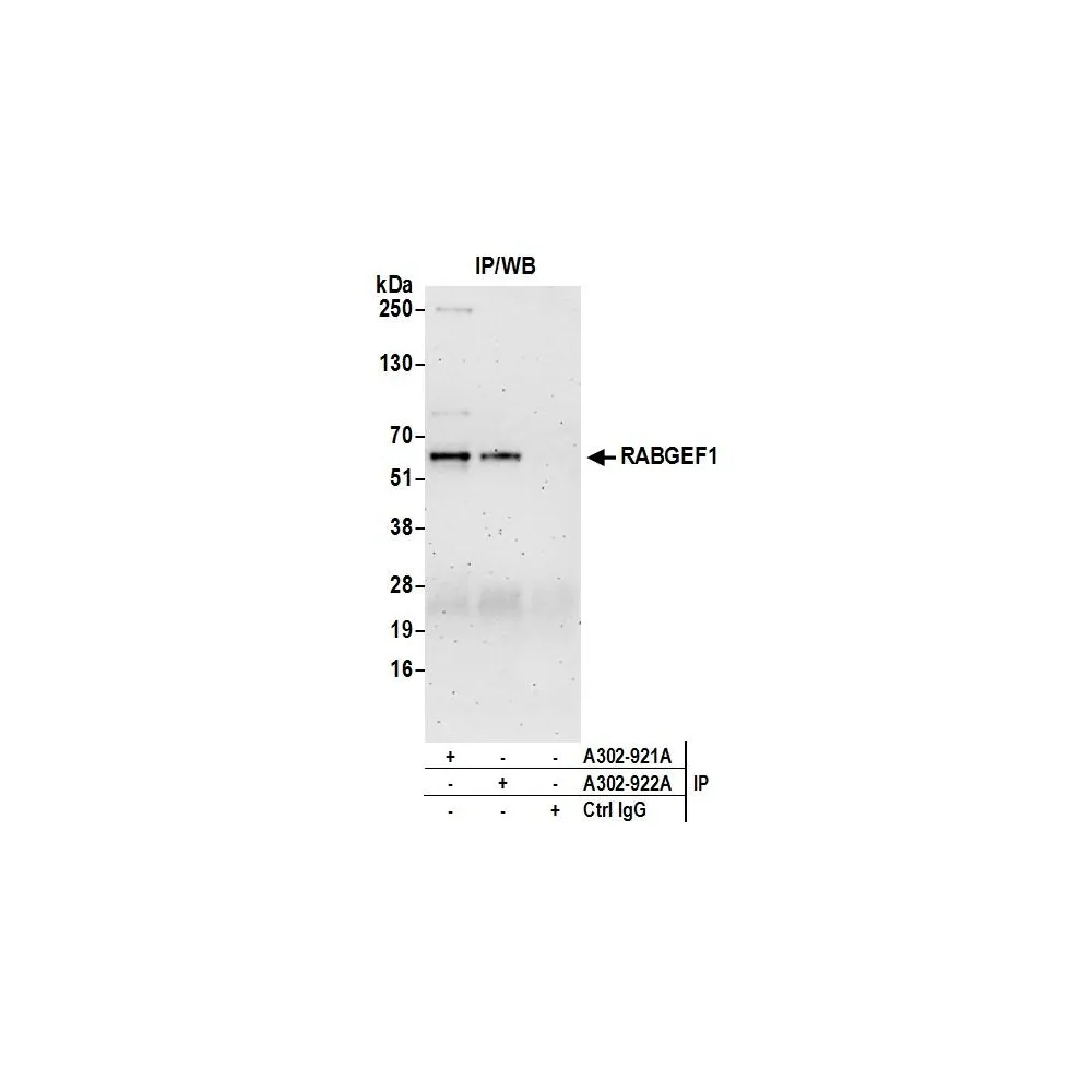 Rabbit anti-RABGEF1 Antibody, Affinity Purified