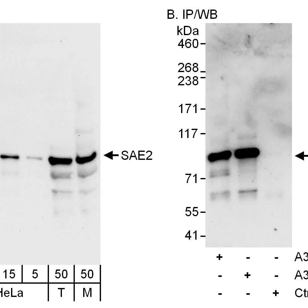 Rabbit anti-SAE2 Antibody, Affinity Purified