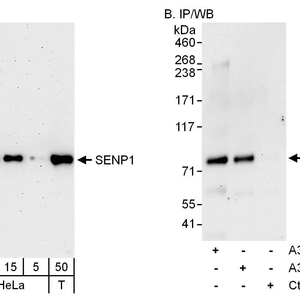 Rabbit anti-SENP1 Antibody, Affinity Purified