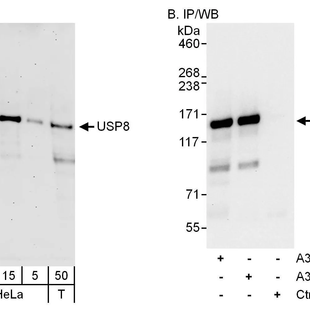 Rabbit anti-USP8 Antibody, Affinity Purified