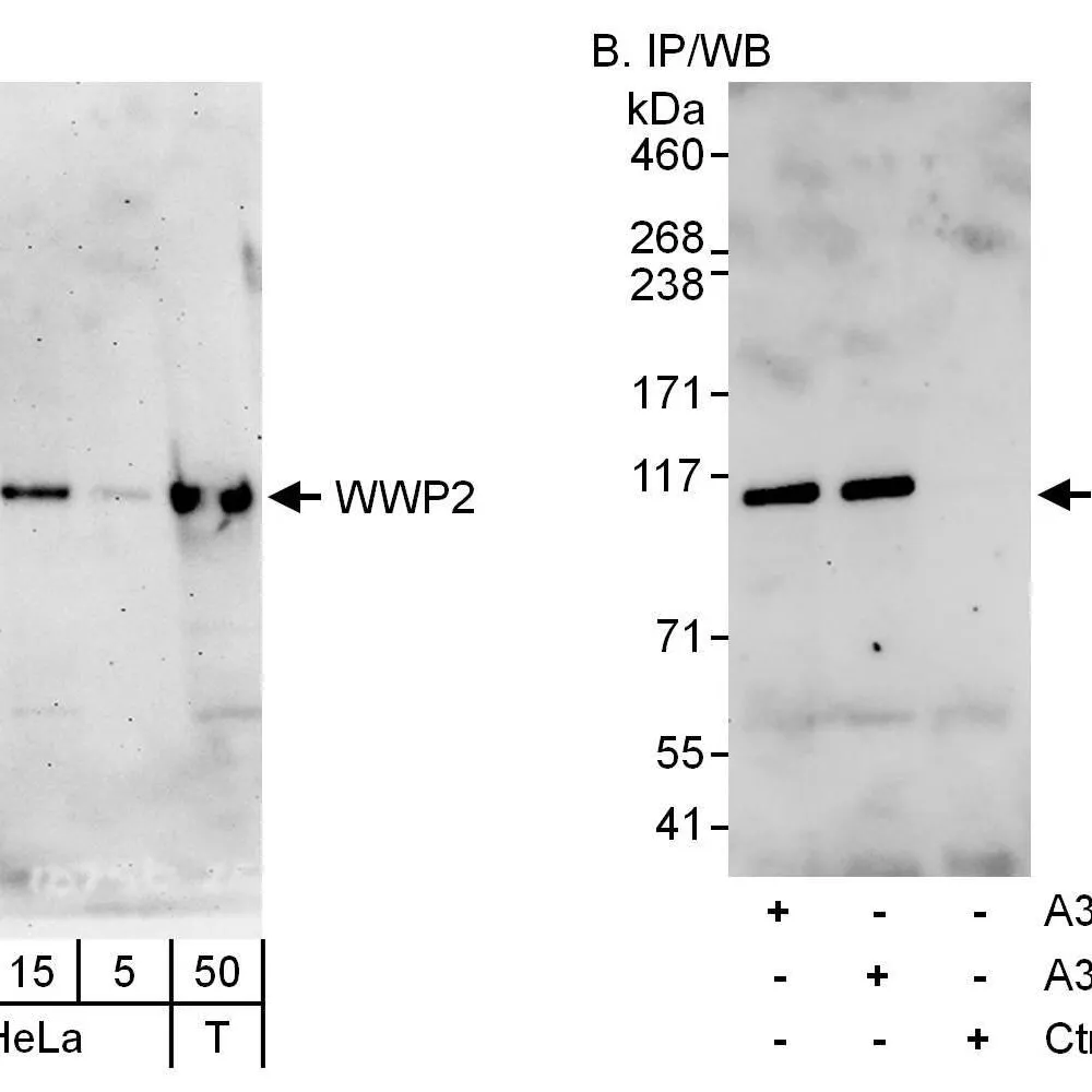 Rabbit anti-WWP2 Antibody, Affinity Purified