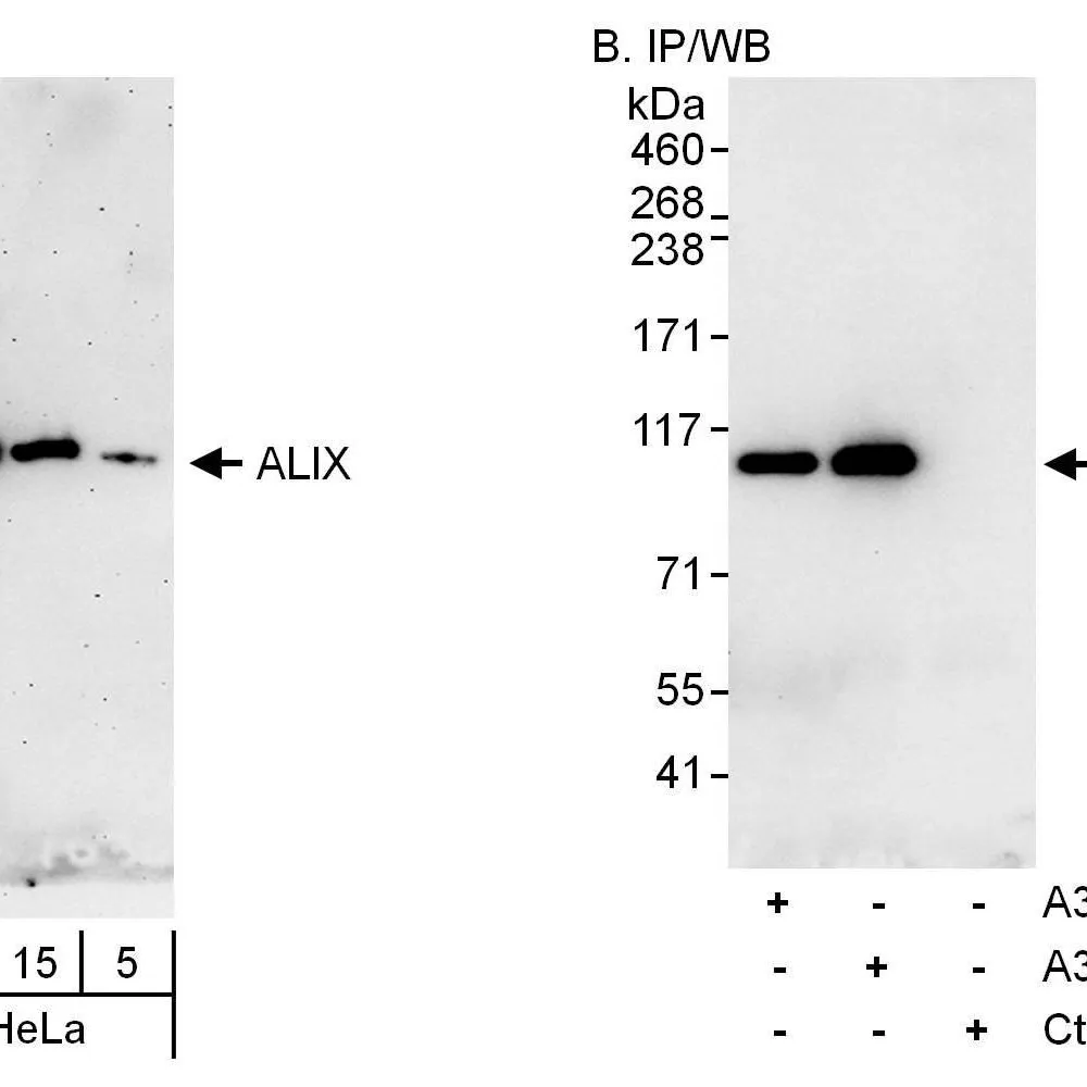 Rabbit anti-ALIX Antibody, Affinity Purified
