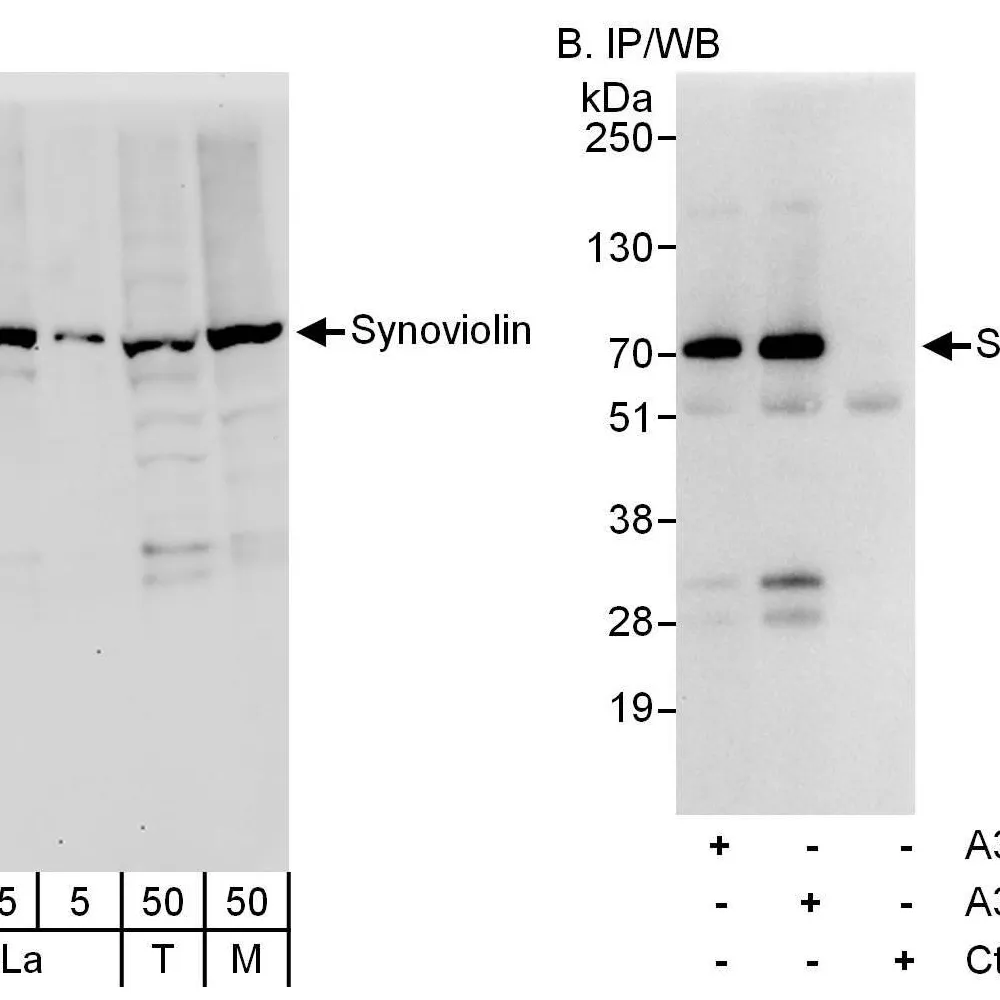 Rabbit anti-Synoviolin Antibody, Affinity Purified