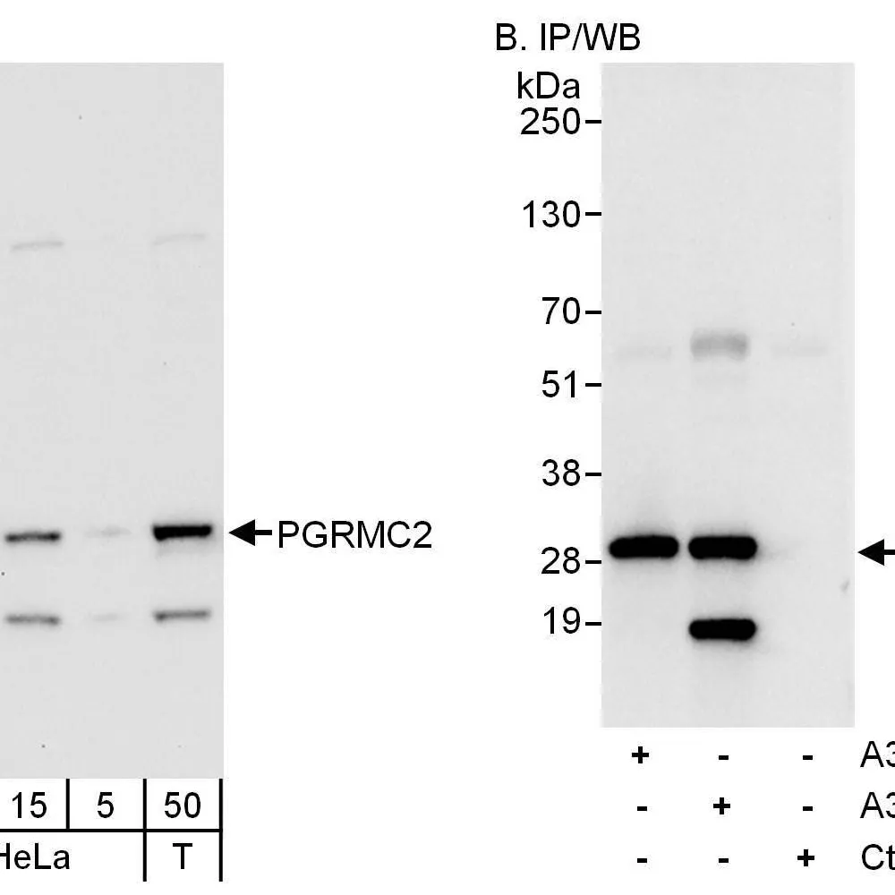 Rabbit anti-PGRMC2 Antibody, Affinity Purified