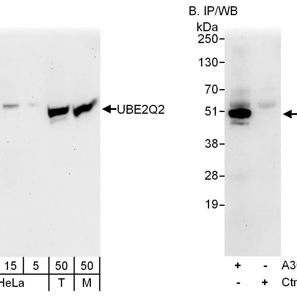 Rabbit anti-UBE2Q2 Antibody, Affinity Purified