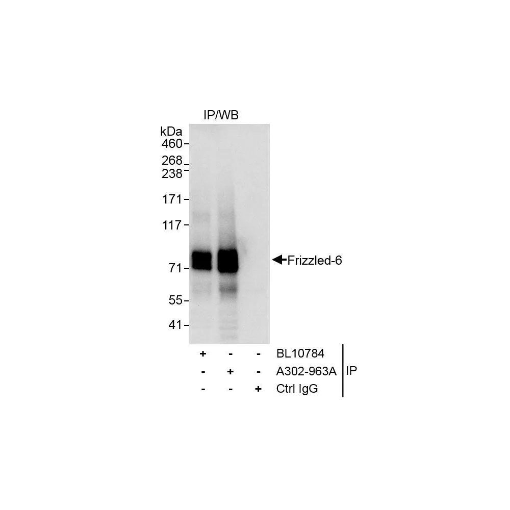 Rabbit anti-Frizzled-6 Antibody, Affinity Purified