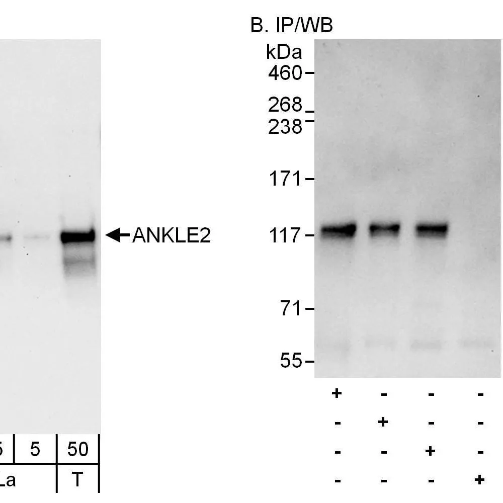Rabbit anti-ANKLE2 Antibody, Affinity Purified