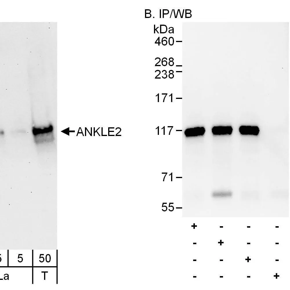 Rabbit anti-ANKLE2 Antibody, Affinity Purified
